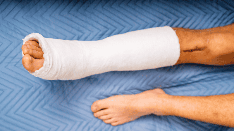 Timing Is Critical in Personal Injury Claims