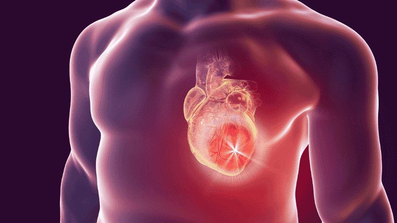 Cardiology Negligence: When Heart Care Fails